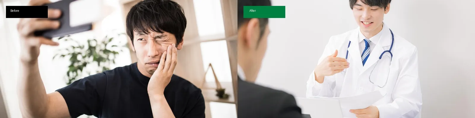 インプラントの症例写真