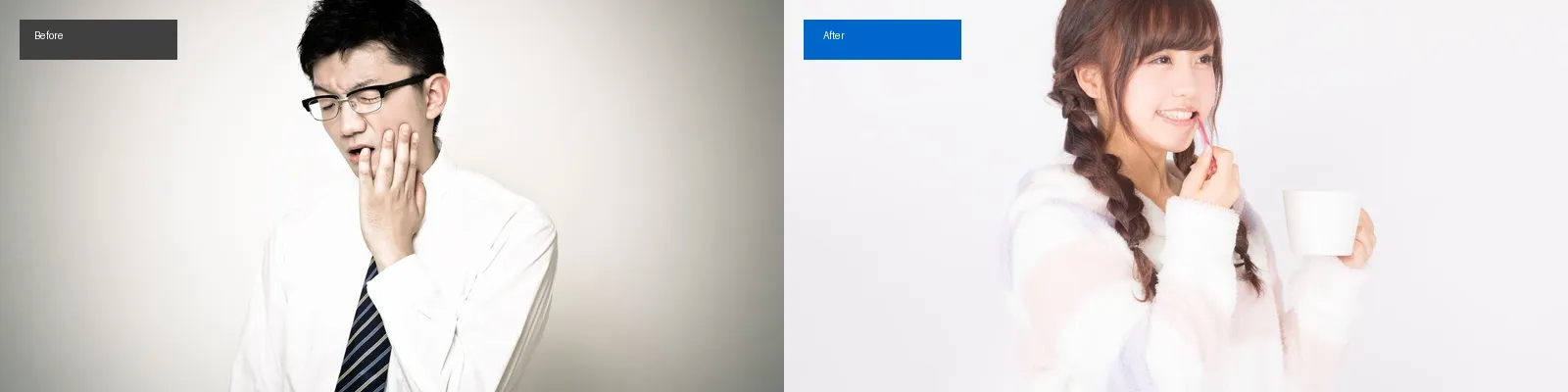 矯正歯科の症例写真
